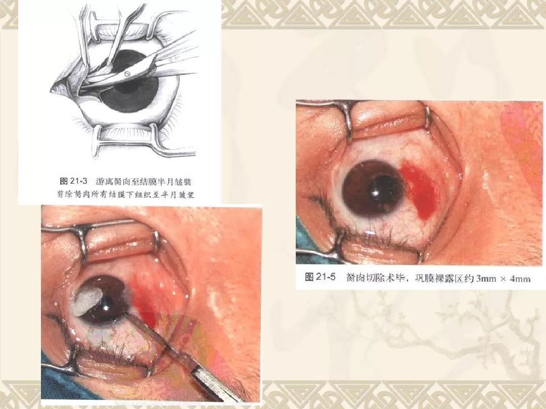 全球眼是 监控业务_监控眼全球业务是做什么的_监控眼全球业务是什么