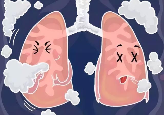 咳嗽白痰肺癌-咳嗽有白痰，肺癌的早期症状？别慌，先看看这篇文章