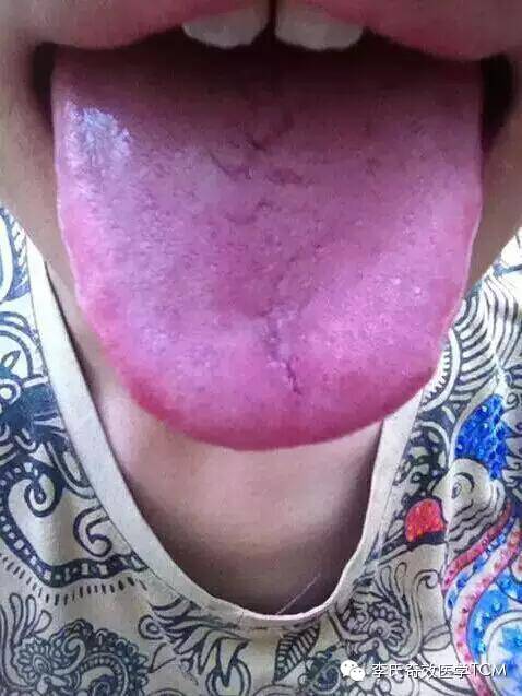 c盘d盘都满了怎么办_只有c盘d盘不见了_c盘d盘是磁盘吗