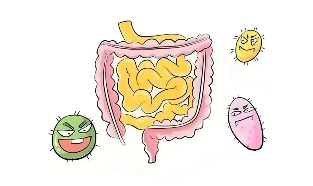 回盲部腺体增生_回盲部腺瘤样增生_回盲部腺样征