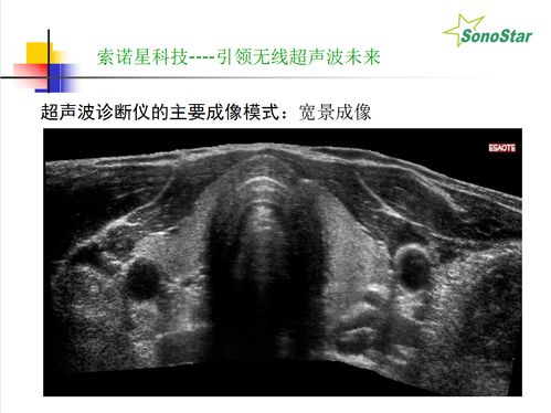 无线b超安卓系统,便捷医疗检测新体验