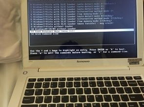 安卓系统电视的好处,智能生活新体验的五大优势